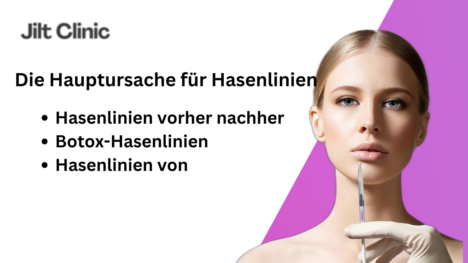 Hasenlinien durch Botox